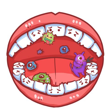 嘴巴生虫|龋齿（牙齿细菌性疾病）